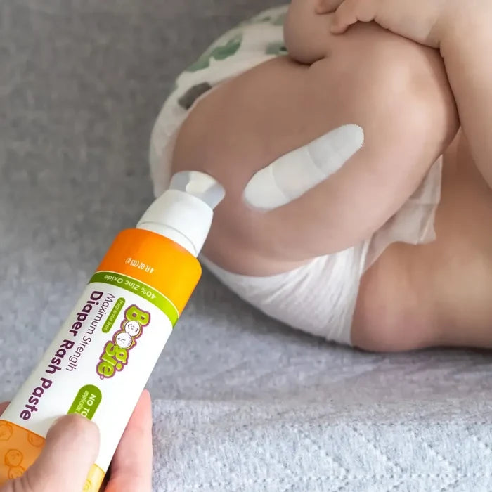 Child in a diaper with a rash, holding a bottle of Oipple Rash Paste.