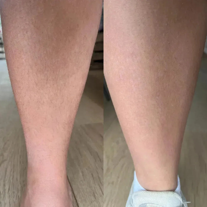 Keramene body hair minimizer depilatory cream - Hairgivers