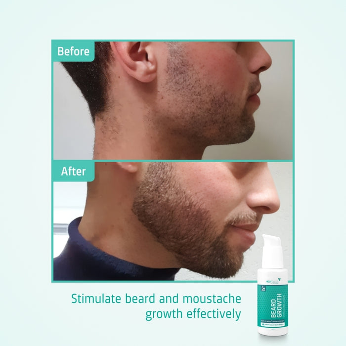 Neofollics beard growth serum (7% Neoxyl)