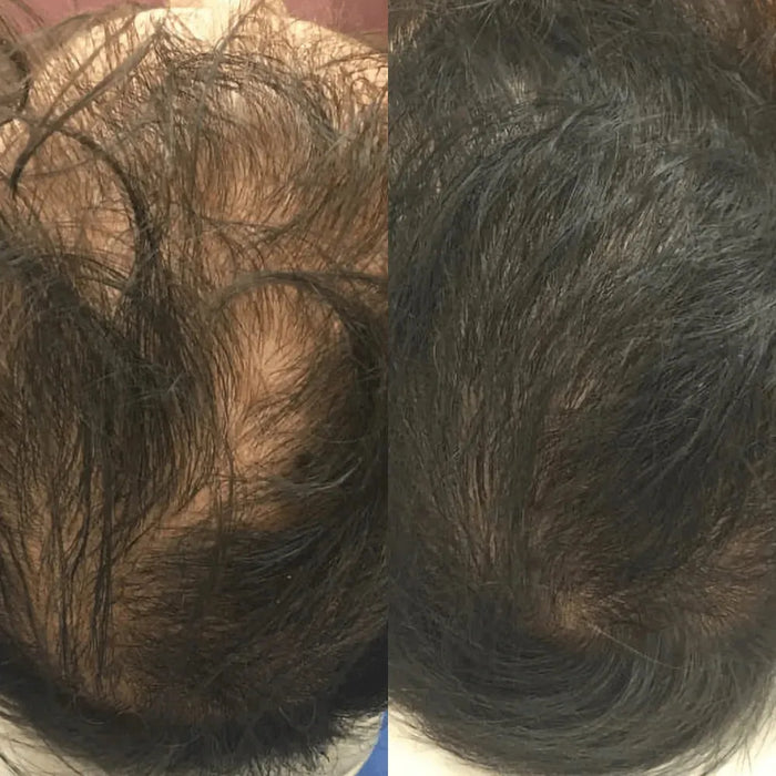 Revita tablets for hair growth (1 month) - Hairgivers