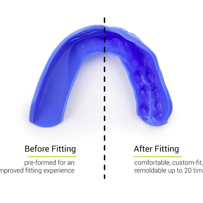 SISU 3D Mouthguard