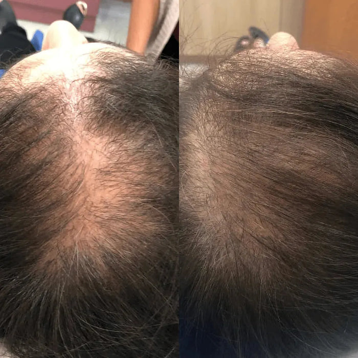 Spectral.CSF (Adenosine) lotion - Hairgivers